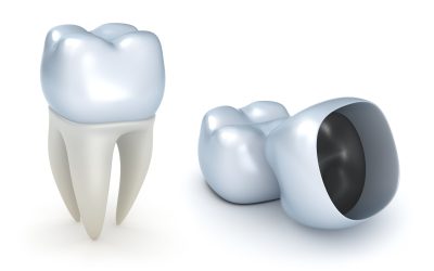 Learn More About Dental Root Canals in Keizer OR